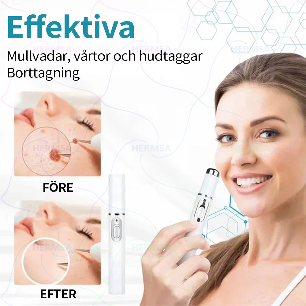 Hermsa® ikke-invasiv laserskaler - fjerning av bein og vorter (🔥Siste dag 80% rabatt)
