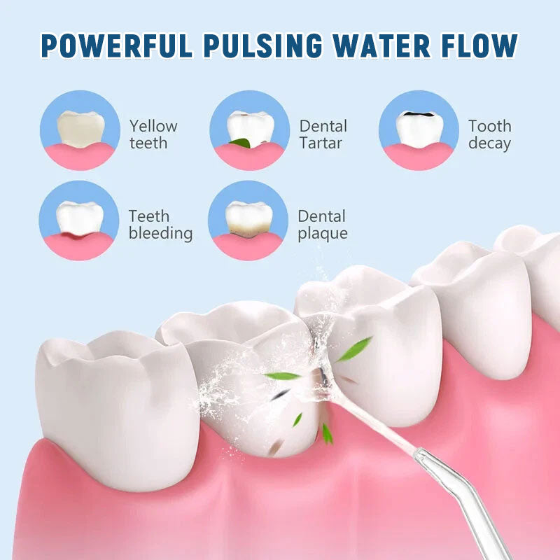 🦷 Elektrisk Vannflosser – Hold tennene rene etter hvert måltid