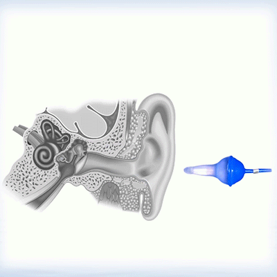 💥2025 NYTT DESIGN – 👂Verdens første oppblåsbare ørepropp med væske