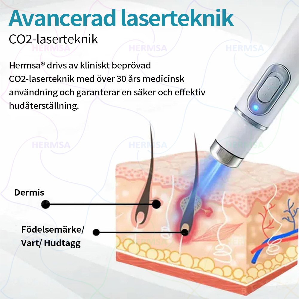Hermsa® ikke-invasiv laserskaler - fjerning av bein og vorter (🔥Siste dag 80% rabatt)